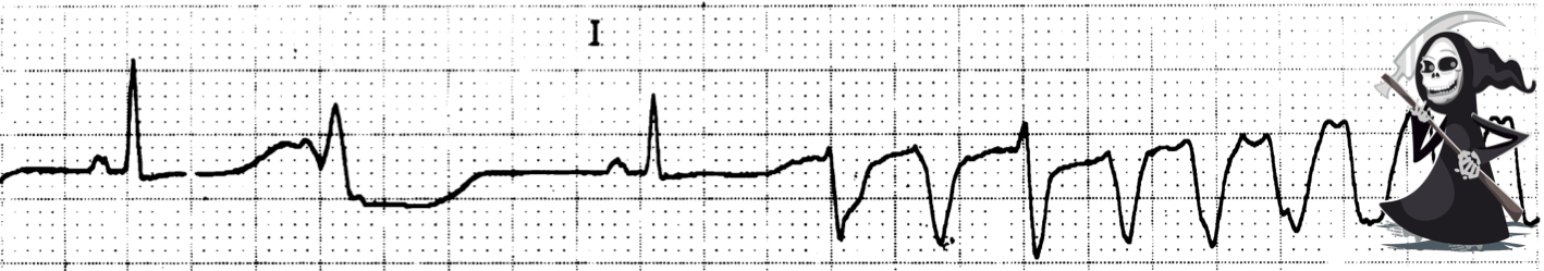 Cost Of Zyprexa