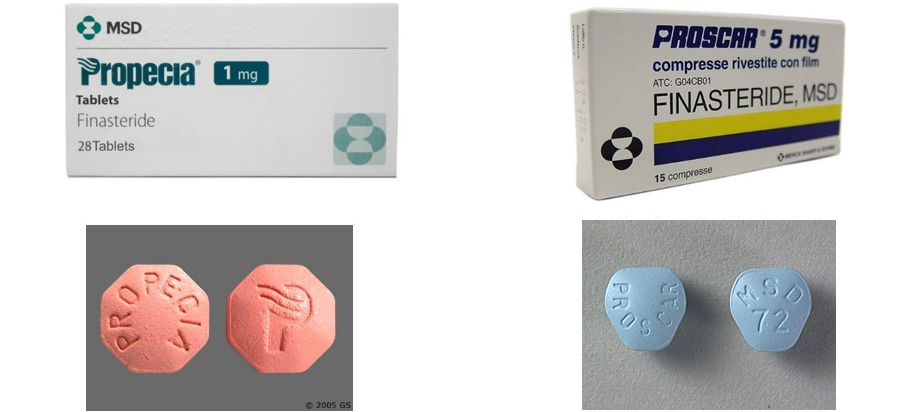 Finasteride 5mg Tablets Generic Proscar